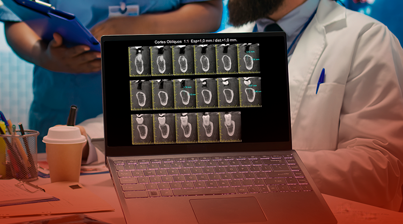 8 - Ortho X - Site- Cone Beam